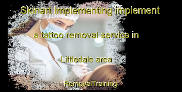 Skinart Implementing implement a tattoo removal service in Littledale area | RemovalTraining | RemovalClasses | SkinartTraining-Australia